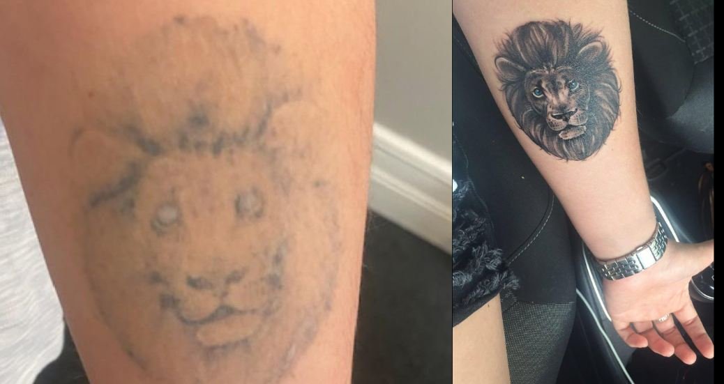 Tattoo Removal Manchester cover