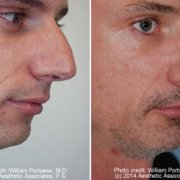 The Seattle Facial Plastic Surgery Center